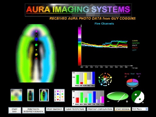WinAura Star Imaging Software