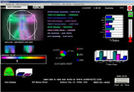 WinAura software